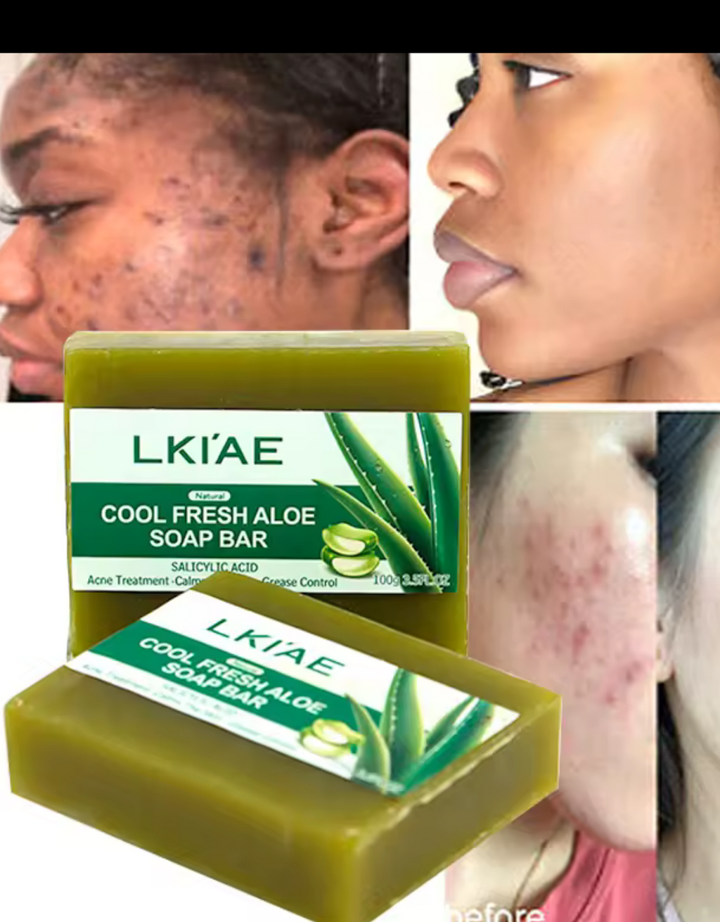 Hot Selling 100g Solid Effective Acne Removal Facial Glowing Smoothing Deep Cleansing Bath Cool Fresh Aloe Face Soap Bar